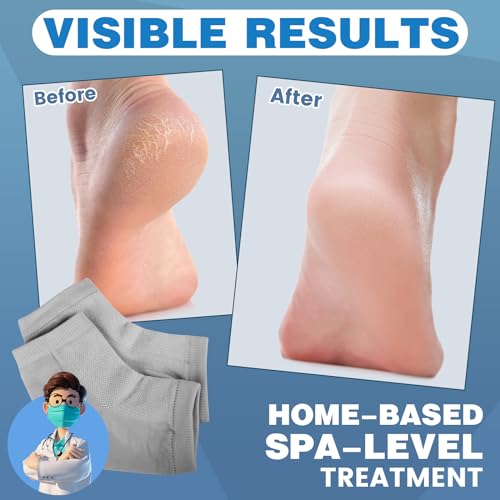 Image of TEAWOO 6 Pairs Moisturizing Heel Socks for Cracked Heel Treatment