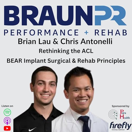 Brian Lau & Chris Antonelli: Rethinking the ACL BEAR Implant Surgical & Rehab Principles