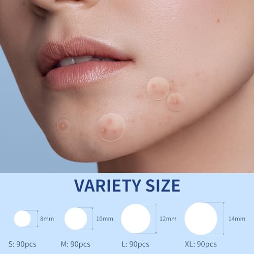 Image of Daolyo Pimple Patches for Face, 4 Size 360 Counts Hydrocolloid Acne Patches for Covering Zits and Blemishes, Spot Stickers with Salicylic Acid, Tea Tree Oil & Calendula Oil, Mini Package