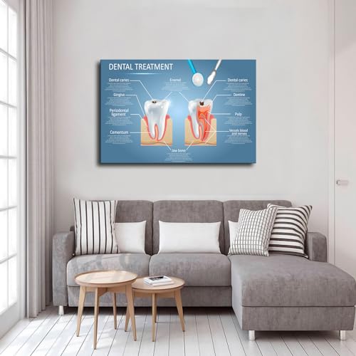 Vector Dental Anatomy and Tooth Structure Diagram Poster Modern Family Bedroom Office Background Wall Art HD Picture Canvas Printing Artwork Decor Posters (12×18inch-Framed)