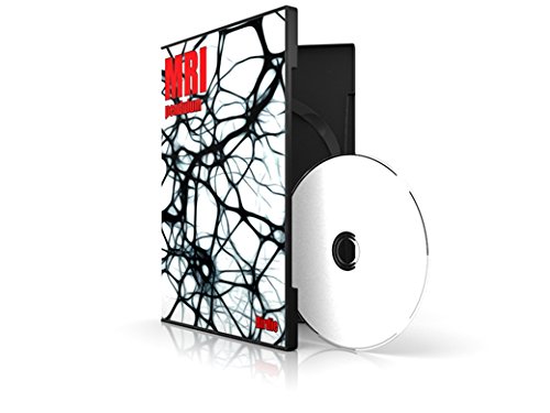 PDFダウンロード MRI ペンデュラム バイ