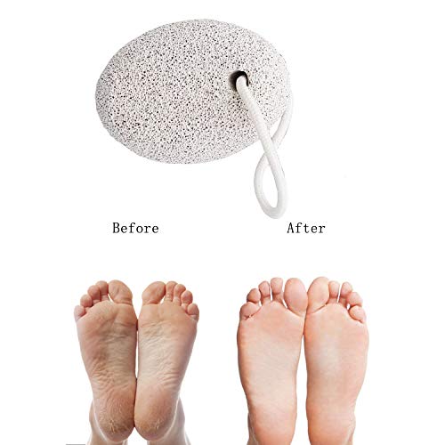 image for Pumice Stone for Feet 4 pcs, KUTOLAKI Natural Lava Pumice Stone, Pumic