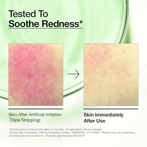 30% Off Anua Azelaic Acid Serum for Blemish-Prone Skin