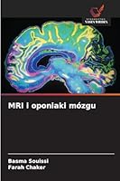 MRI i oponiaki mózgu 6208986966 Book Cover