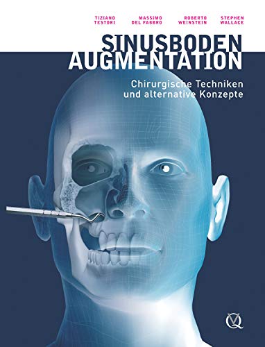 Sinusbodenaugmentation Chirurgische Techniken Und Alternative Konzepte German Edition Ebook Testori Tiziano Del Fabbro Massimo Weinstein Roberto Wallace Stephan Amazon It Kindle Store