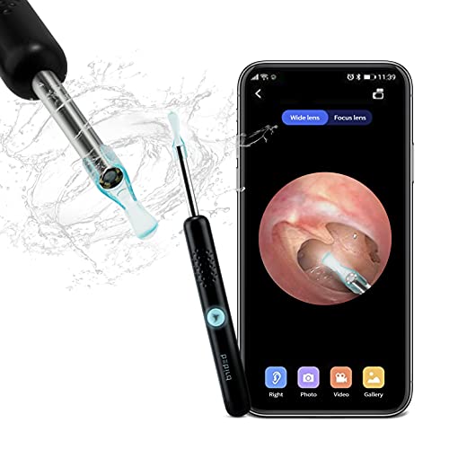 BEBIRD Ear Wax Removal Tool,Ear Cleaner with Scope Camera,1080P FHD Portable Wireless Visual Ear Otoscope Pen Compatible with iPhone,Android Smart Phones,Suitable for Kids Adults