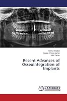 Recent Advances of Osseointegration of Implants 3659684910 Book Cover