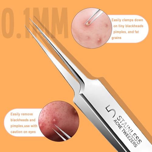 FNANJWQ 7 Pcs Pimple Popper Tool Kit Professional Stainless Steel Blackhead Remover Tools for Removing Zit on Face Comedone Extractor Squeezing Tools with Plastic Case for Skin Care - Thumbnail 5