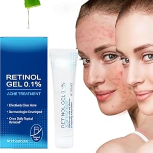 Retinol Gel,Retinol Gel for Face, Retinol Acne Treatment Gel & Skin Soothing Cream,Anti-Acne Moisturizer with Retinol, Spot Treatment for Acne-Prone Skin, Oil-Free,Non-Comedogenic