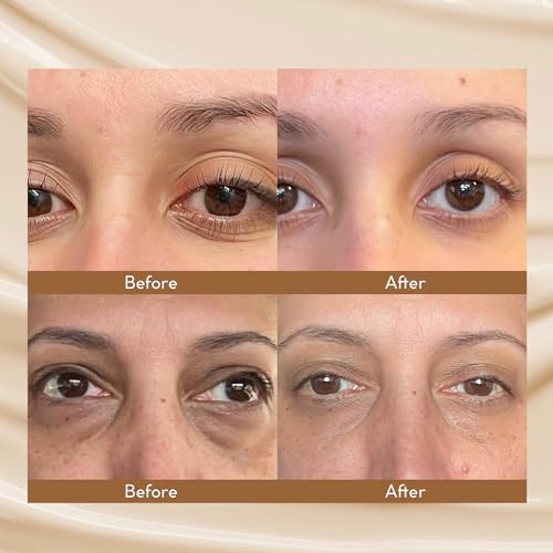 VELAMO ADVANCED Caffeine Eye Cream: for Dark Circles Puffiness Under Eye Bags Wrinkles Fine Lines 0.5 OZ/15g