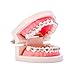 Easyinsmile Dental Orthodontic Teeth Model with Metal Bracket Tooth Model with Braces for Patients Communication