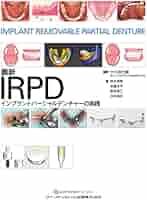 Amazon.co.jp: 最新IRPD インプラントパーシャルデンチャーの