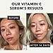 EL GANADOR Sérum de Vitamina C Cara/Cuello/Ojos – 5 VECES MÁS POTENTE...