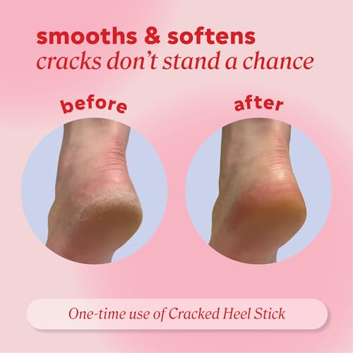 Onyx Professional Cracked Heel Repair Balm Stick for Dry Cracked Feet Treatment, Coconut Scent, 1 pack - Moisturizing Foot Balm, Rolls On, Cracked Heel Treatment - Image 5