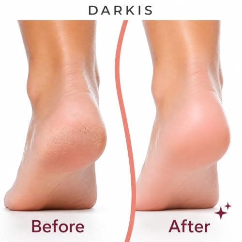 Image of DARKIS Callus remover for feet, dead skin remover electronic pedicure tools | Perfect foot scrubber and cleaner machine (Pink)