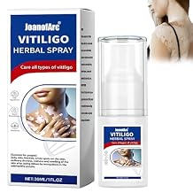 JoanofArc Vitiligo Spray, Skin Care Mist Infused with botanical ingredients to nourish the skin, Suitable for Improve Skin Vitiligo, Leukoplakia, Suitable for Men and Women