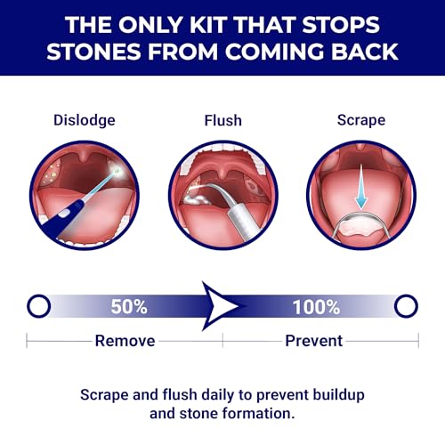 Oravix 7-Piece Tonsil Kit
