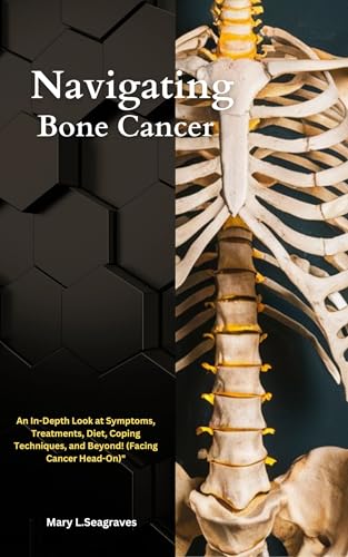 Navigating Bone Cancer: : An In-Depth Look at Symptoms, Treatments, Diet, Coping Techniques, and Beyond! (Facing Cancer Head-On)" (On This Facing Cancer Series Book 1)