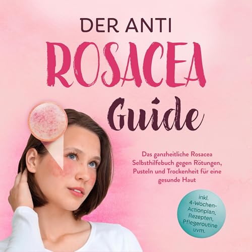 Der Anti Rosacea Guide Audiolibro Por Helena Sandkamp arte de portada