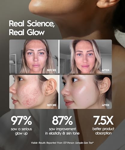 REVO Genie Facial Massager for Face and Neck, LED Beauty Device with Heat and Vibration, Depuffing Sculpting Tool with Red Blue Green Light Modes for Skincare Routine - Image 5