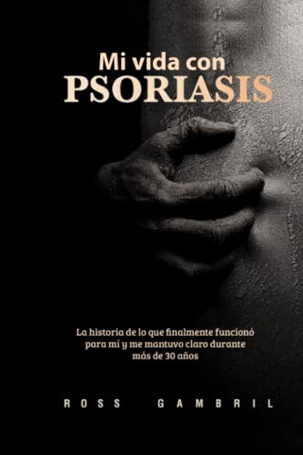 Mi vida con PSORIASIS: La historia de lo que finalmente funcionó para mí y me mantuvo claro durante más de 30 años