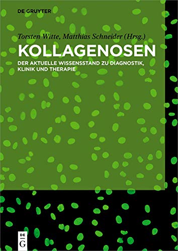Kollagenosen: Der aktuelle Wissensstand zu Diagnostik, Klinik und Therapie