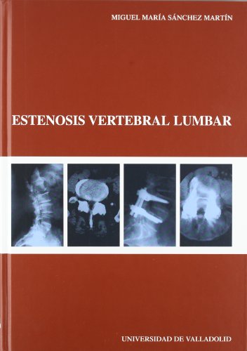Portada de Estenosis Vertebral Lumbar