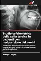 Studio cefalometrico della sella turcica in pazienti con malposizione dei canini (Italian Edition) 6208817471 Book Cover
