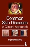 Textbook of Ilizarov Surgical Techniques Bone Correction and Lengthening