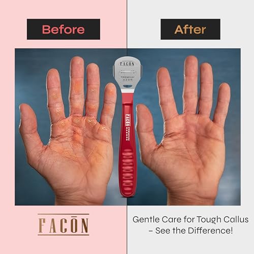 image for FACON Facón Professional Callus Shaver Remover with 50 Blades, Pedicu