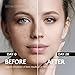 EnaSkin Dark Spot Remover Face & Body Serum: Age Spot Sun Spot Freckles - 1.0 Fl Oz