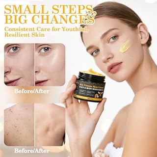 Lustrchron 2PCS Bee Venom Skin Cream, Natural Ingredients Non-Irritating Bee Venom Cream, Wrinkle Lift & Firming, Reduces Blemishes, For Face & Full Body, 2 * 60g