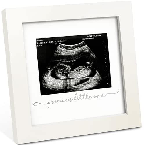 KeaBabies Baby Sonogram Picture Frame - Modern Ultrasound Picture Frames