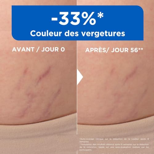 Mixa - Huile Anti-Vergetures - 30% d’Omégas 6 & 9 - Réduit la Couleur, la Texture et l’Épaisseur des Vergetures Post-Grossesse ou Variations de Poids et de Taille - 100 ml – Image 4