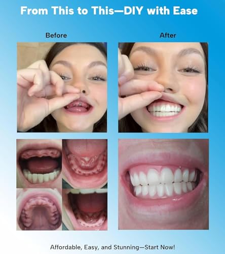 Image of DIY Oral Care Kit at Home, 2 Complete Sets, Fully Customizable | Fully /Partial, Upper /Lower, Customizable 2 Sets with 3 Size, Custom Smile Kits