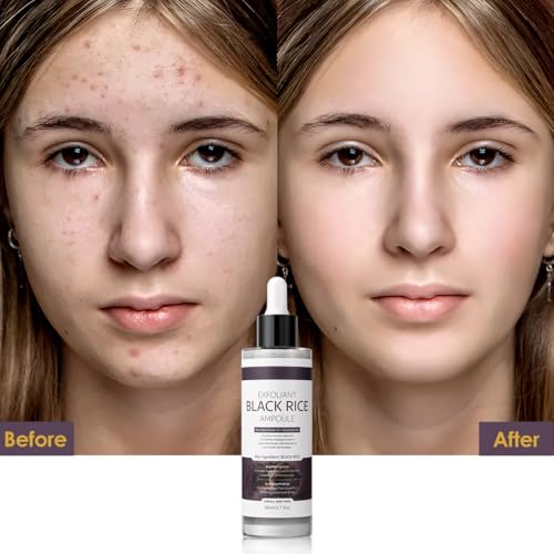 Image of Peel Shot Glow Black Rice Exfoliant Peeling Ampoule, Soft Exfoliating Brightening Serum, Face and Body Scrub, Facial Exfoliator, Deep Hydration, 80ml