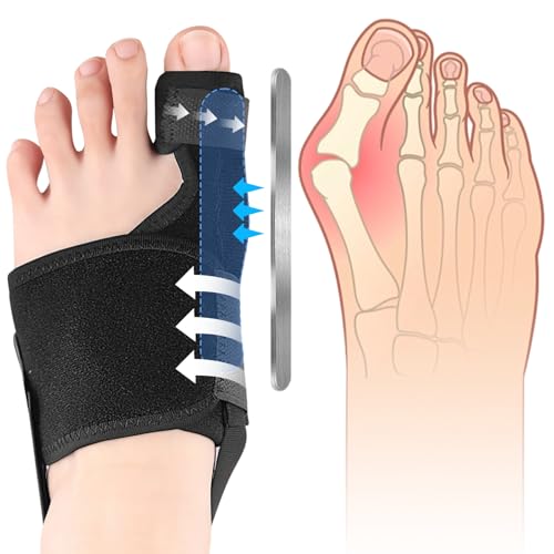Correcteur Hallux Valgus, Réutilisable Redresseur Orteil Antidérapant, Réglable Nuit & Jour Ecarteur D'orteil Oignon, Séparateurs D'orteils Avec, Pour hallux valgus...