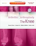 Arthritis and Arthroplasty: The Knee: Expert Consult - Online, Print and DVD