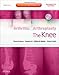 Arthritis and Arthroplasty: The Knee: Expert Consult - Online, Print and DVD