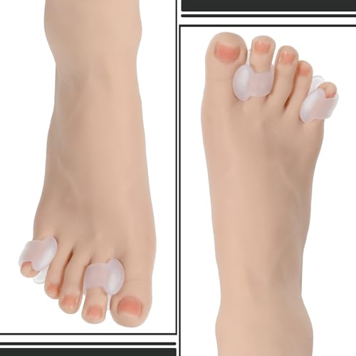 10 Pack Toe Spacers for Overlapping Toe, Gel Toes Spacers Straightener Hammer Toes Corrector for Feet Gel ToeSeparators for Men and Women Bunion Spacer Separators for Overlapping ToeWomen