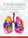 Tuberculosis and Nontuberculous Mycobacterial Infections