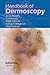 Handbook of Dermoscopy