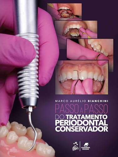 Passo a Passo do Tratamento Periodontal Conservador