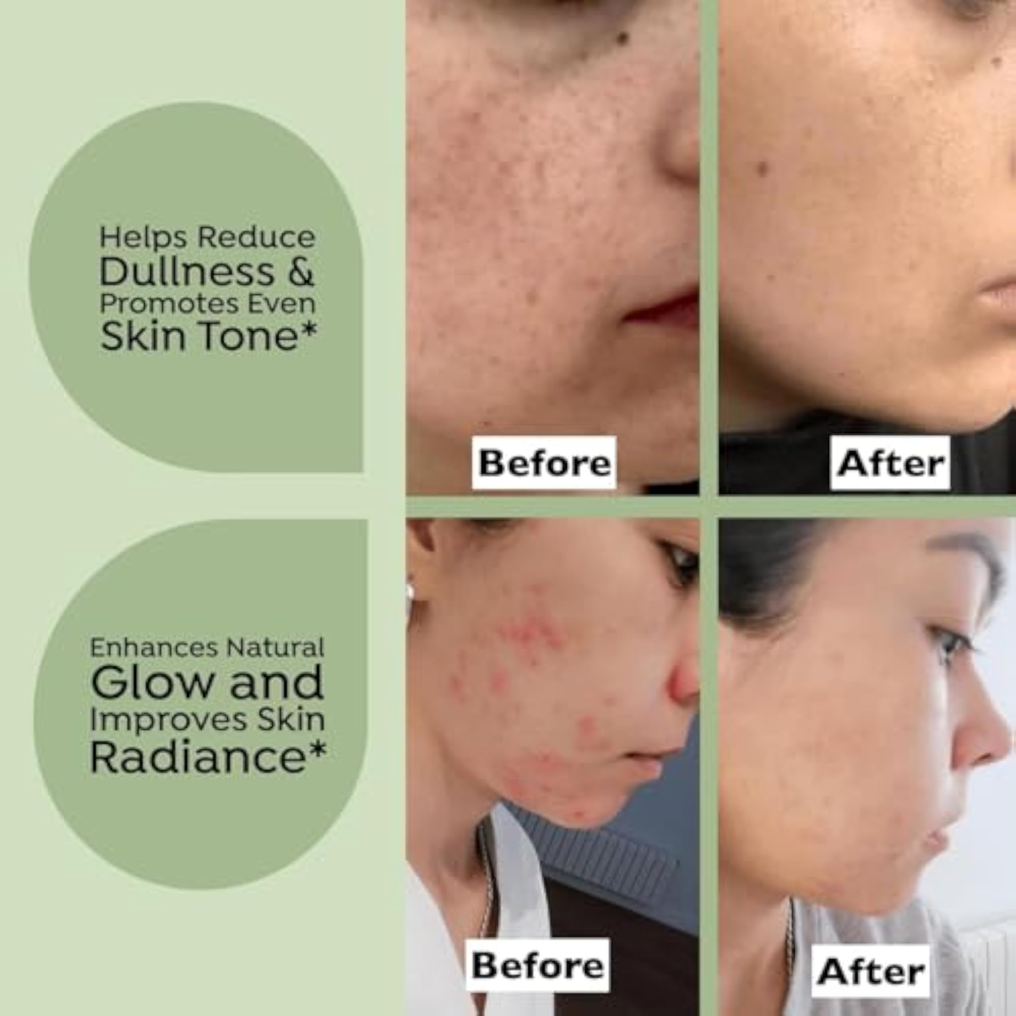 MiskuCosmo NYRA Skin Brightening Face Serum, Superfood Formula