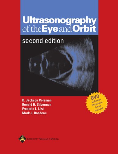 Ultrasonography Of The Eye And Orbit - //medicalbooks.filipinodoctors.org