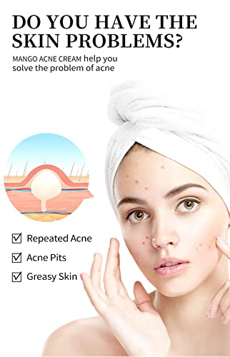Easilydays Mango Repair Acne Cream, Face Pimple Removal Cream Acne Scar Treatment, Moisturize Skin, Fade Pockmarks Gently And Shrink Pores, For Acne Scar Removal, Spots, Balanced Water And Oil #TOP1