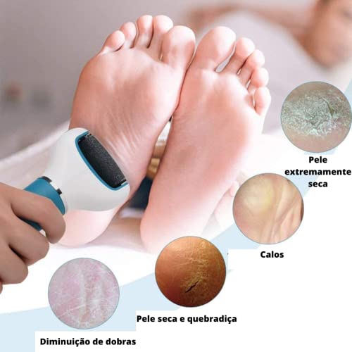 Aparelho Esfoliador Lixar Pé e Calcanhar Elétrico Removedor de Calos Portátil