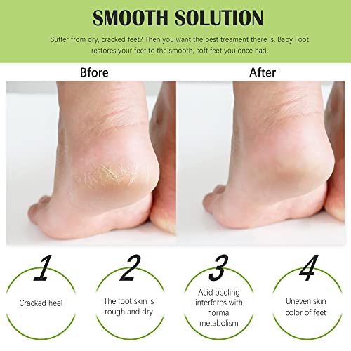 Foot Peel Mask (3 Pairs) - For Cracked Heels, Dead Skin & Calluses - Make Your Feet Baby Soft & Get A Smooth Skin, Removes & Repairs Rough Heels, Dry Toe Skin - Exfoliating Peeling Treatment (Tea Tree) #TOP4