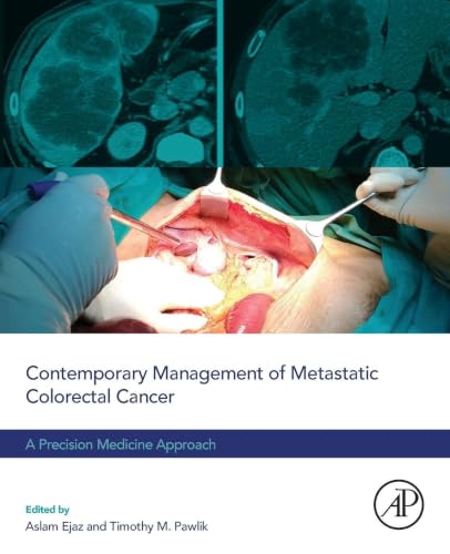 Contemporary Management of Metastatic Colorectal Cancer: A Precision Medicine Approach