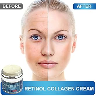 Retinol Cream for Face - Facial Moisturizer with Collagen and Hyaluronic Acid, Anti-Wrinkle Reduce Fine Lines Vitamin C+E Natural-Ingredient Day Night Anti-Aging For Women Men